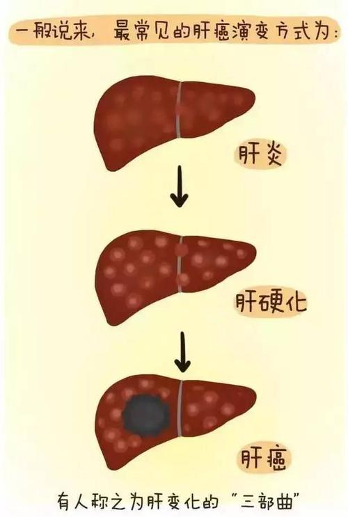 45岁男子深夜昏迷，肝癌离世，医生：1把年纪，这事肝脏承受不起，指的什么事男子在***店死亡视频男子在***店死亡 新能源汽车